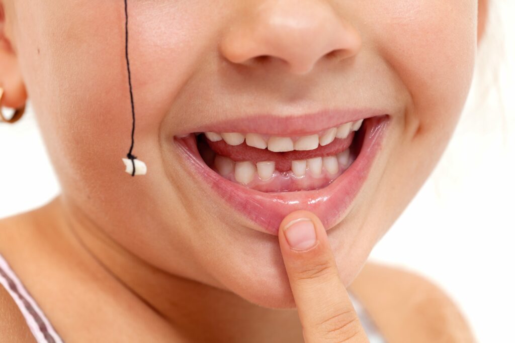 Should I Pull My Child's Loose Baby Tooth?